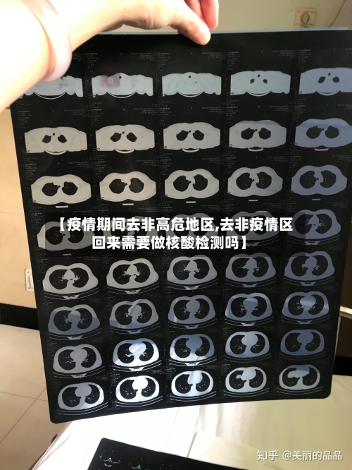 【疫情期间去非高危地区,去非疫情区回来需要做核酸检测吗】-第3张图片
